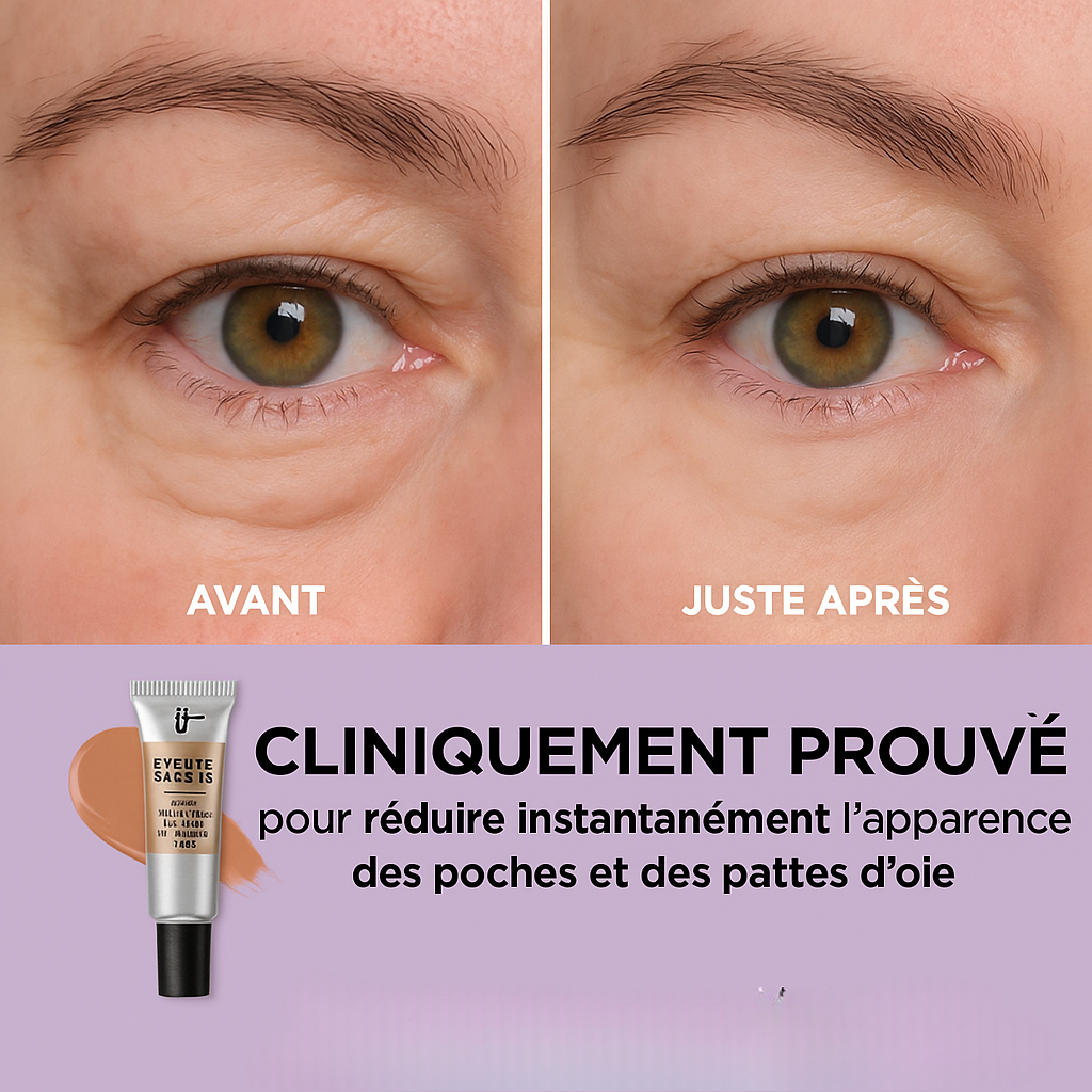 Instant Anti-Wrinkle Eye Treatment