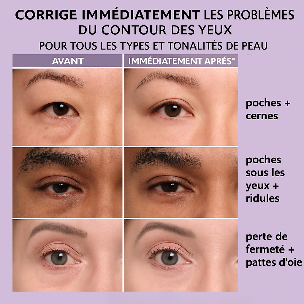 Instant Anti-Wrinkle Eye Treatment