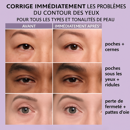 Instant Anti-Wrinkle Eye Treatment